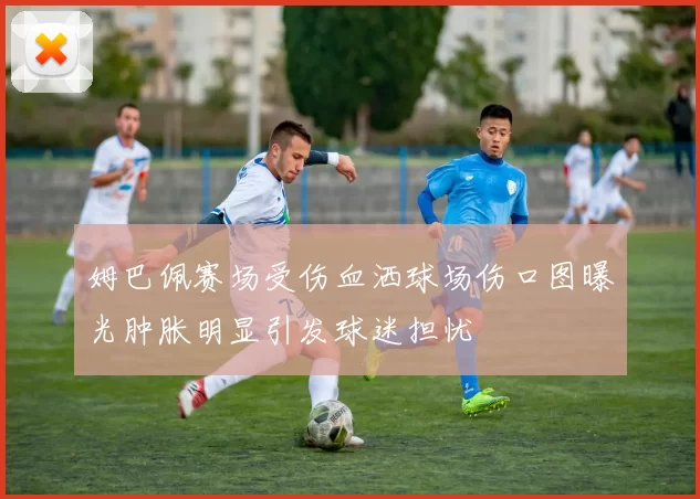 姆巴佩赛场受伤血洒球场伤口图曝光肿胀明显引发球迷担忧